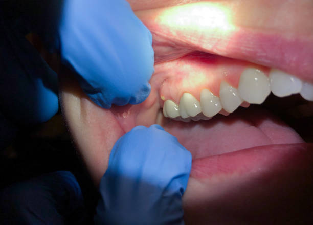 Best Emergency Treatment for Toothache in Remlap, AL